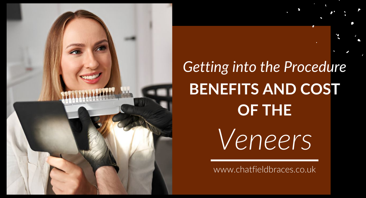 teeth veneers cost in London