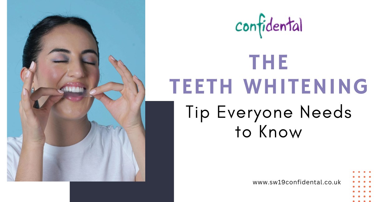 Teeth Whitening in Wimbledon